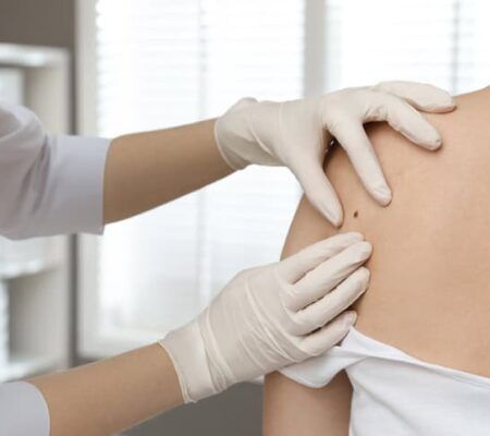 Dermatologist examining patient's birthmark in clinic, closeup view