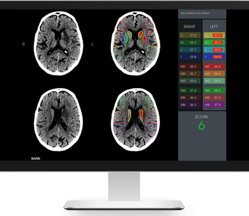 Imaging view of brain