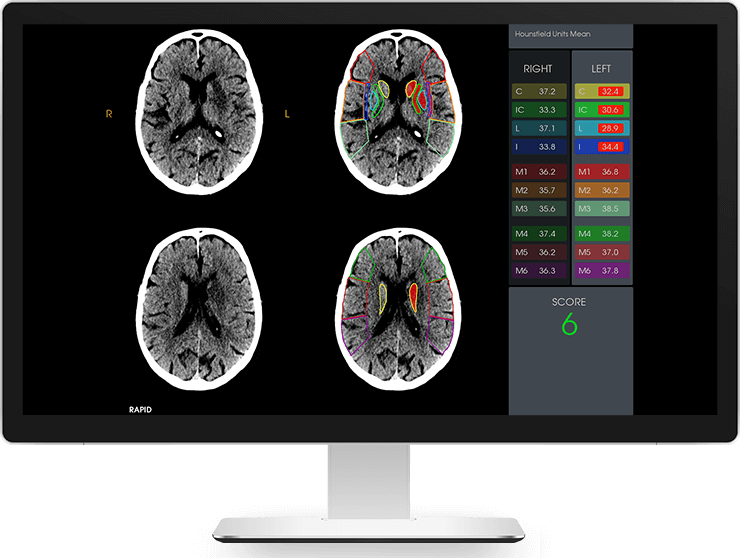 Imaging view of brain