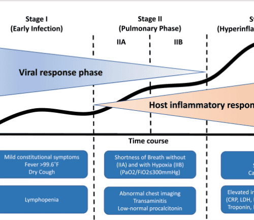 COVID-19 disease progression chart showing three stages with viral response and inflammatory phases