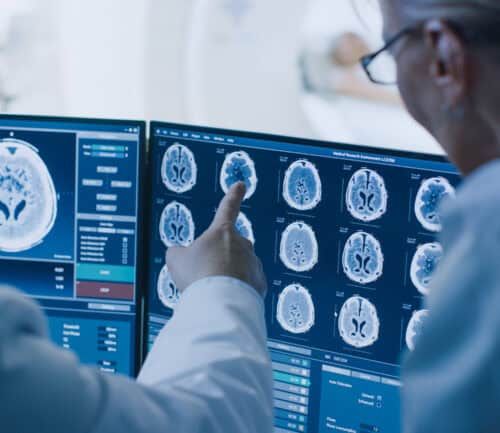 Doctors analyzing brain scan images on computer monitors in hospital control room