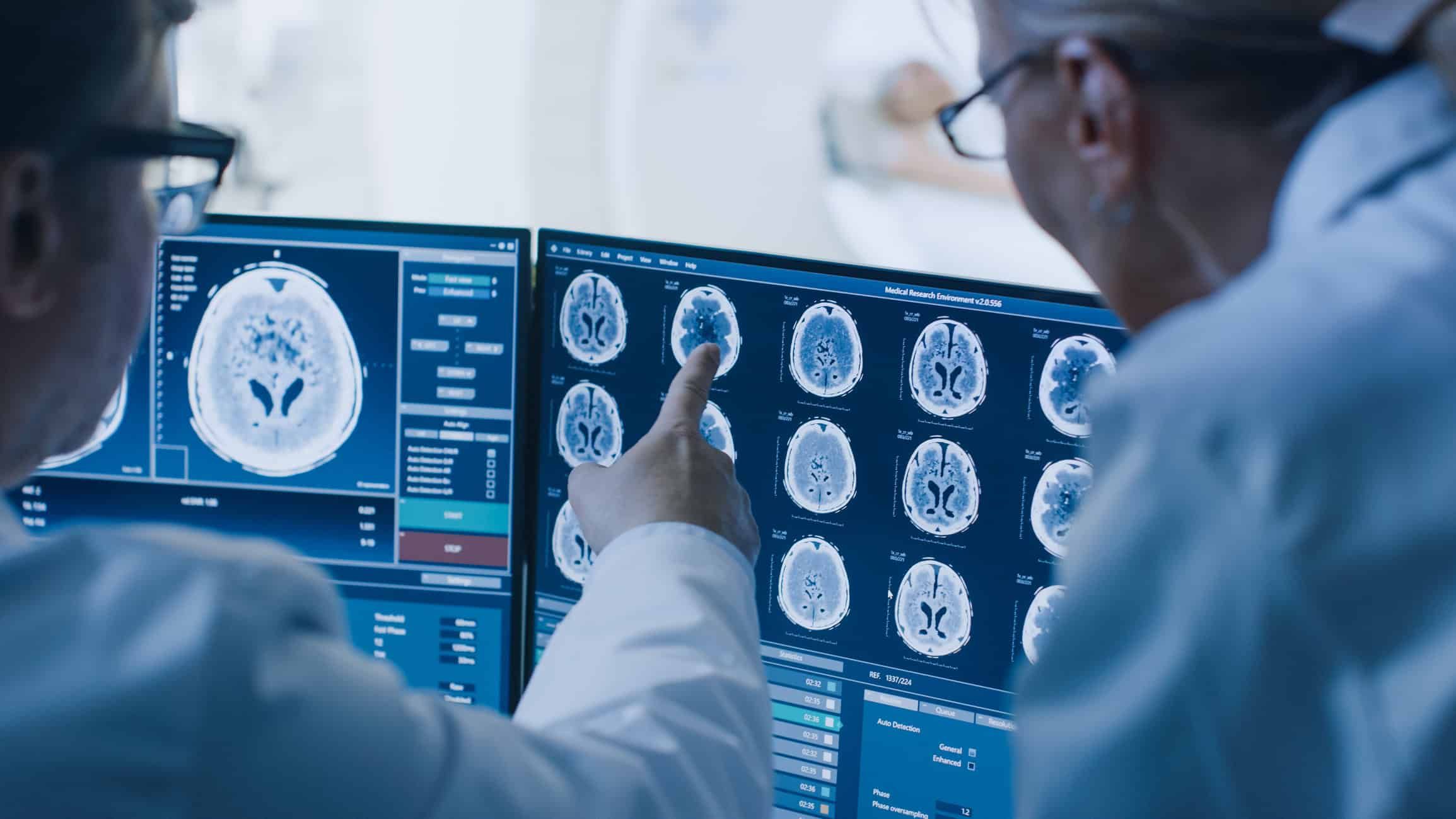 Doctors analyzing brain scan images on computer monitors in hospital control room
